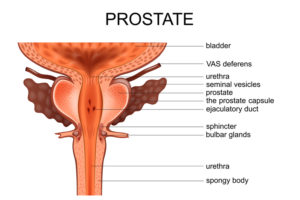 Prostate Cancer and its Relationship to ED