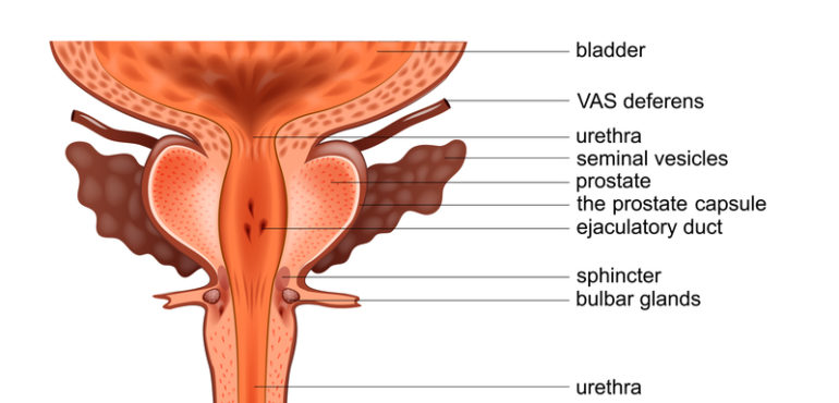 Prostate Cancer and its Relationship to ED