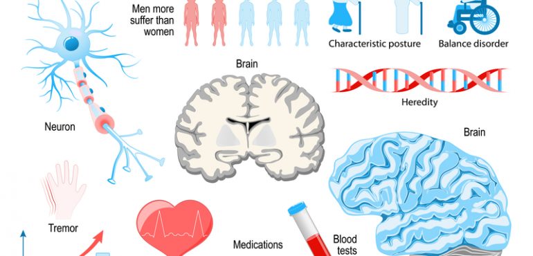 Understanding Sexual Dysfunction and Parkinson’s Disease